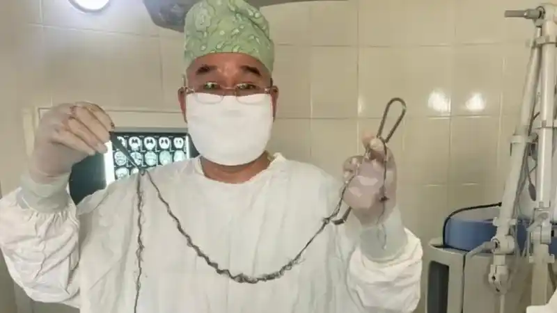 Kırgızistanlı çocuğun beyninden saç çıktı