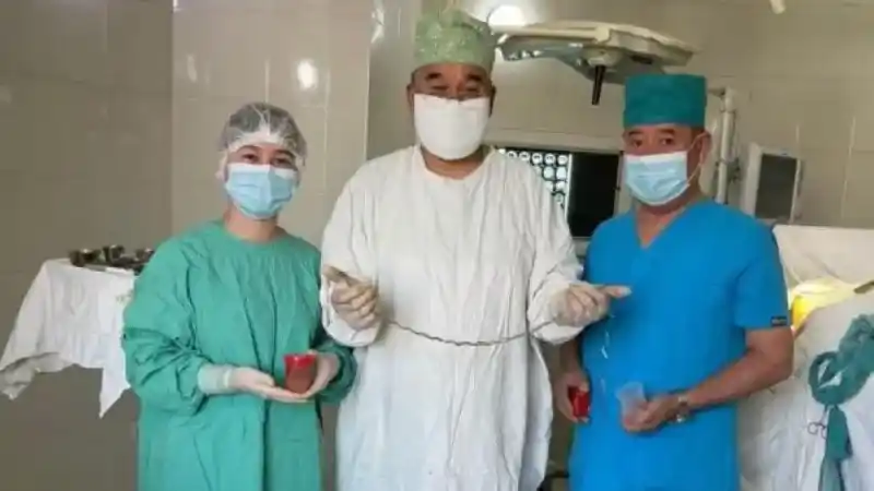 Kırgızistanlı çocuğun beyninden saç çıktı