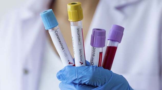 Dünya Sağlık Örgütü: Koronavirüs aşısı minimum 12-18 ay uzakta