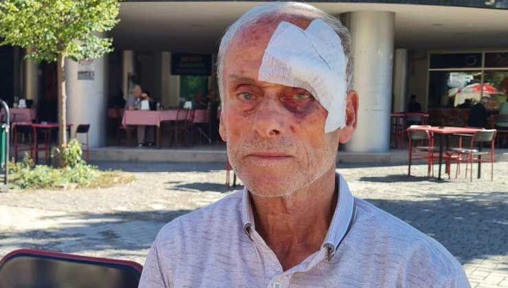 57 yıllık CHP üyesi parti binasında darp edildi