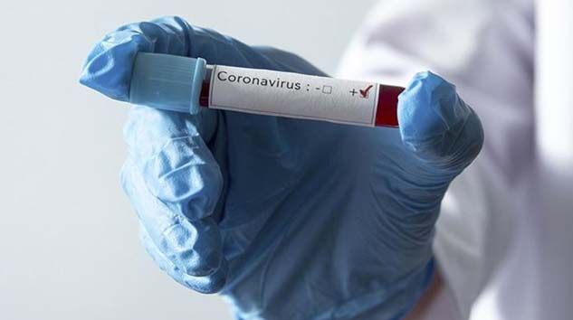 Kovid-19 nedeniyle ölenlerin sayısı dünya genelinde 30 bini aştı