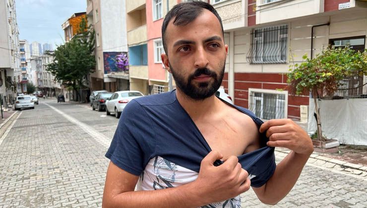 Birol Güneş borç verdiği parayı geri isteyince öldüresiye dayak yedi