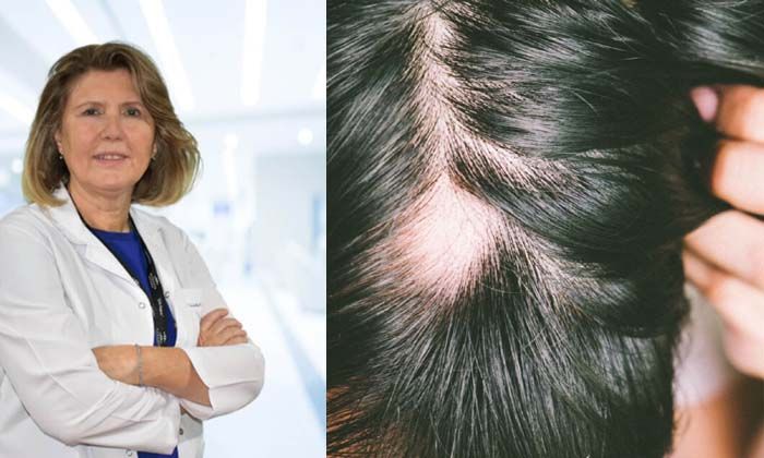 Saçkıran ve saç dökülmesi sebepleri