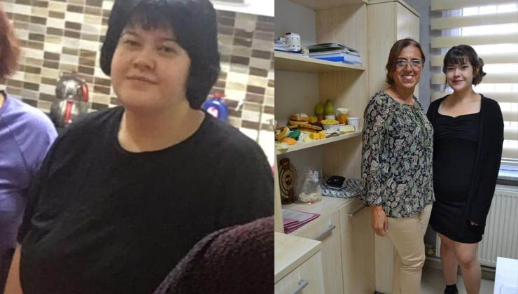 Genç kızın büyük azmi! Doğru beslenerek tam 50 kilo verdi
