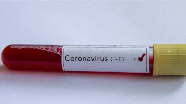 Dünya genelinde Kovid-19 bulaşan kişi sayısı 859 bini geçti