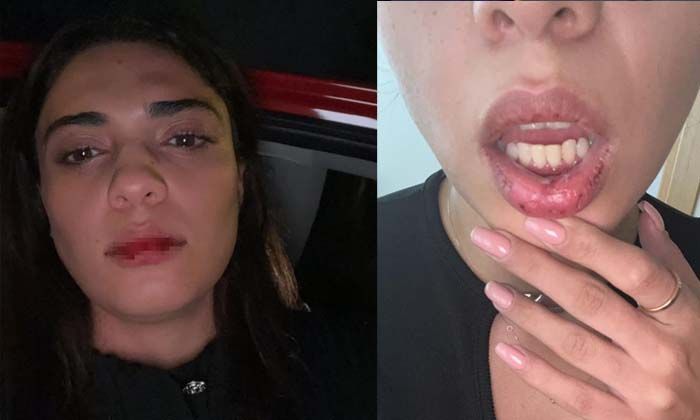 Azerbaycanlı şarkıcı Nergiz Bagieva, İstanbul’da taksicinin saldırısına uğradı