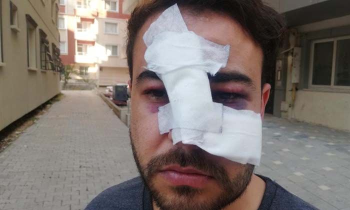 Hatay’da istek şarkıyı bilmeyen müzisyenin yüzünde şişe kırdılar