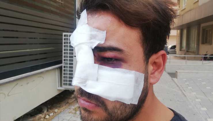 İstek şarkıyı bilmeyen müzisyenin yüzünde şişe kırdılar