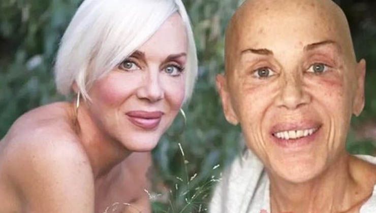 Billur Kalkavan öldü mü? Billur Kalkavan neden öldü, ne kanseriydi?