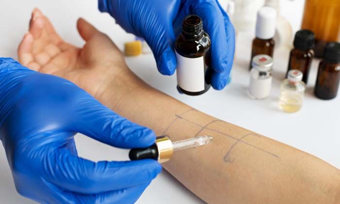 Kene ısırığı kırmızı et alerjisi yapıyor