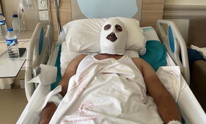 Doğal gaz borusunu tamir etmek için gitti felaketi yaşadı