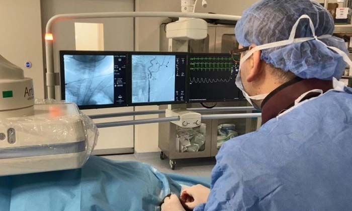 Beyni besleyen ince damarlara uygulanan anjiyo yöntemi dünya tıp literatüründe