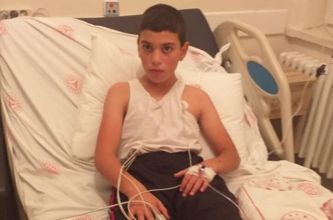 Kuduz teşhisi konulan çocuk hayatını kaybetti