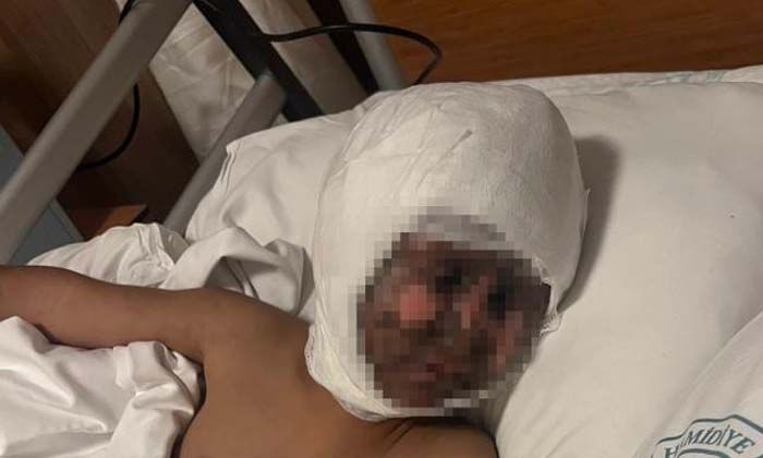 4 yaşındaki çocuğun trafodaki oyunu hastanede bitti