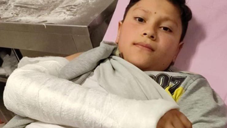 Başıboş köpeğin saldırısına uğrayan 12 yaşındaki çocuk ölümden döndü