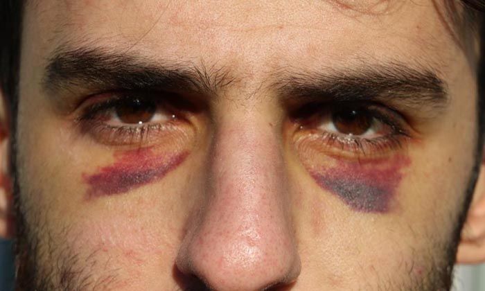 Göçmenler Yunan zulmünü anlattı: Soydular, dövdüler, çıplak halde geri gönderdiler