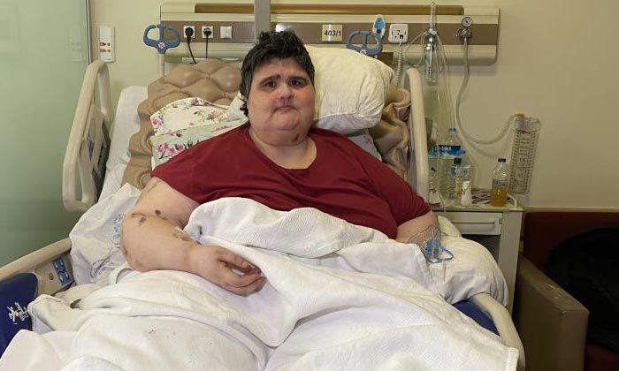 Zayıflamak için internetten ilaç aldı, 350 kiloyu aştı