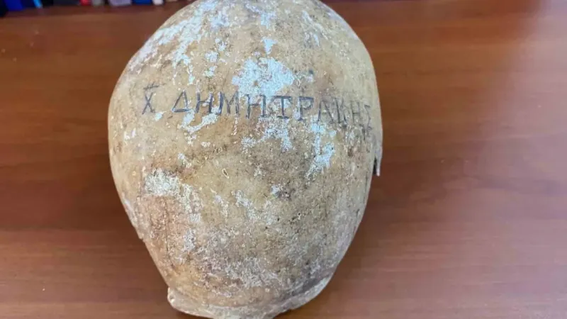 Türkiye’de ilk kez böyle bir kafatasına rastlandı