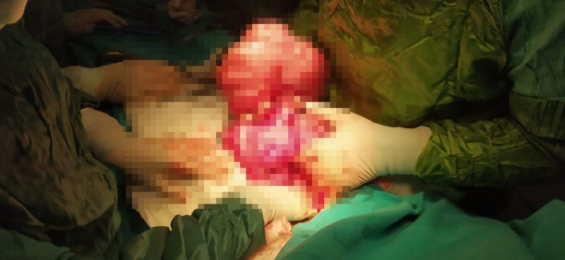 Karnından Çıkanlar Şoke Etti! Karnından Çıkanlar Şoke Etti!