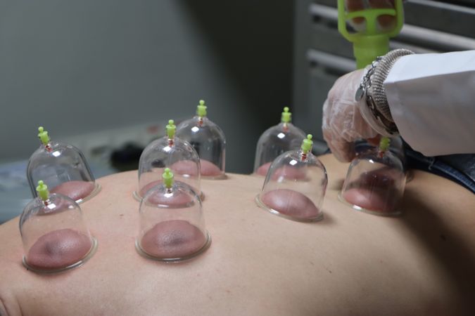 ‘Sülük’ ve ‘Hacamat’ kedavisini uzmana yaptırın