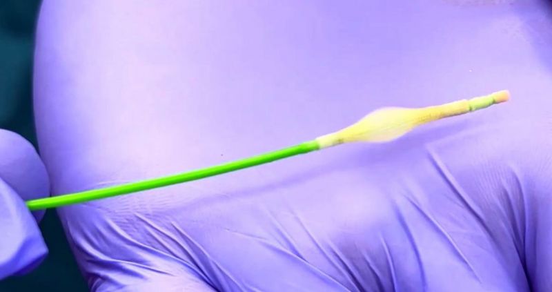 KOAH Hastalarına Rezektör Balon Tedavisi