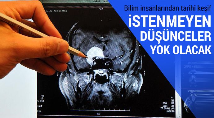 İstenmeyen düşünceleri bastırmayı sağlayan kimyasal bulundu