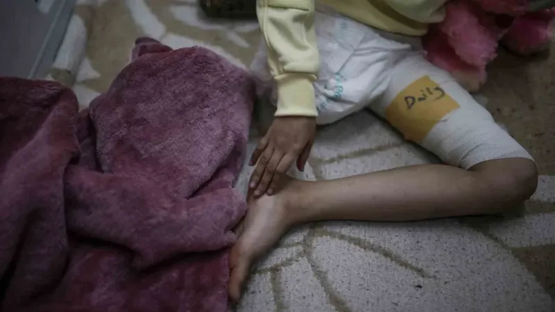 İsrail’in patlayıcı silahları 2024’te her gün 15 çocuğu engelli bıraktı İsrail’in patlayıcı silahları 2024’te her gün 15 çocuğu engelli bıraktı