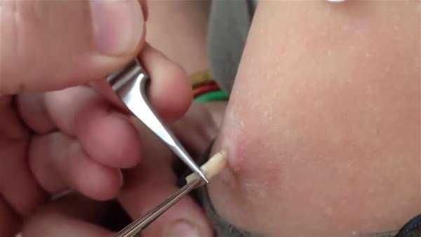 Genç kadının kolundan çıkanlar şoke etti!