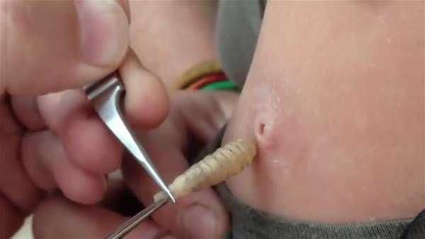 Genç kadının kolundan çıkanlar şoke etti!