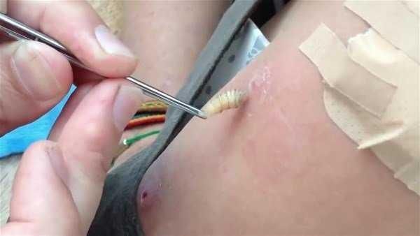 Genç kadının kolundan çıkanlar şoke etti!