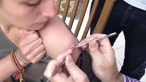 Genç kadının kolundan çıkanlar şoke etti!