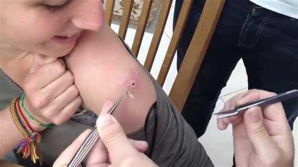 Genç kadının kolundan çıkanlar şoke etti!