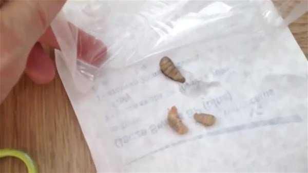 Genç kadının kolundan çıkanlar şoke etti!