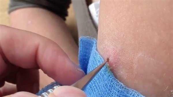 Genç kadının kolundan çıkanlar şoke etti!