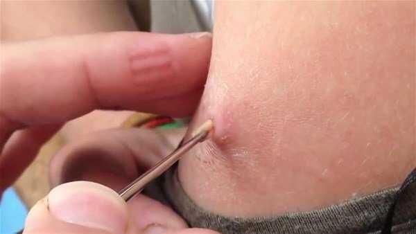 Genç kadının kolundan çıkanlar şoke etti!