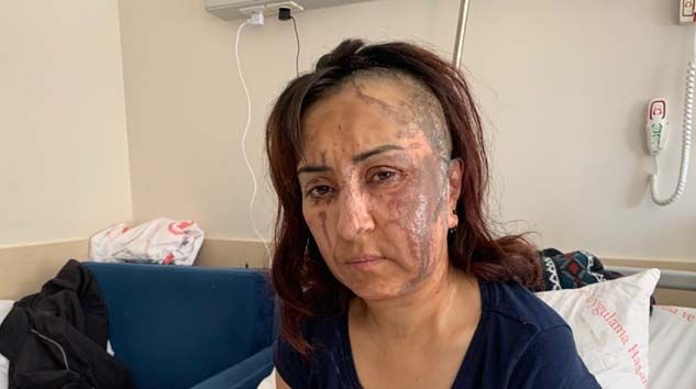 Isparta’da boşanmak isteyen eşe kezzapla saldırı