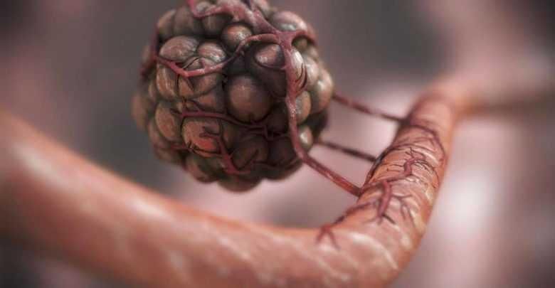 Kanser hücrelerini yok eden virüs bulundu