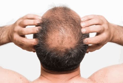 Saç dökülmesini durduruyor!