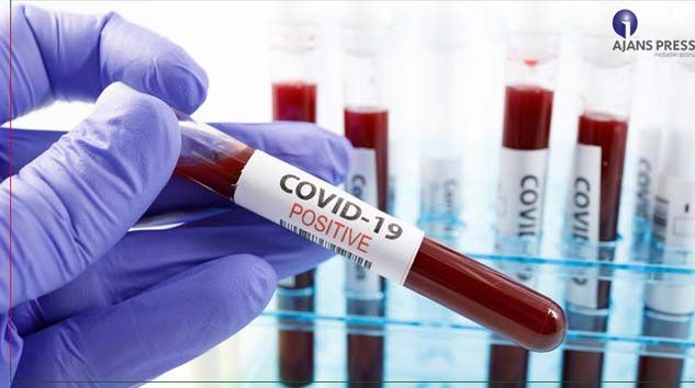 Erciyes Üniversitesinde Covid-19 aşısının hayvanlar üzerinde denemelerine başlandı