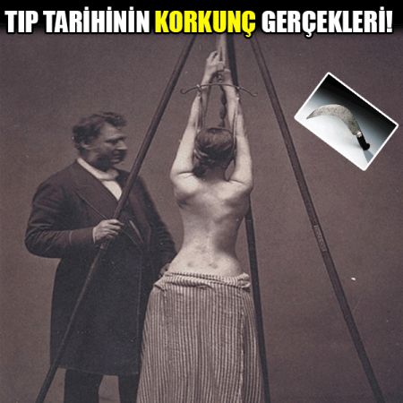 Tıp tarihinin bilinmeyen korkunç tarihi