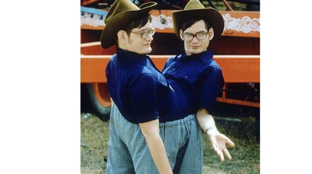 Dünyanın en uzun hayatta kalan yapışık ikizleri 68 yaşında öldü