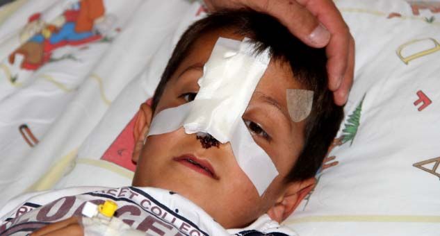 Başıboş dolaşan sokak köpekleri, minik Bünyamin’in burnunu kopardı