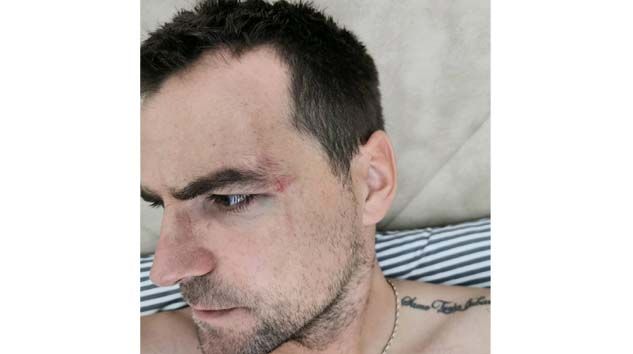 MKE Ankaragücü’nde maç öncesi Ante Kulusic’e saldıran Gerson Rodrigues kadro dışı bırakıldı