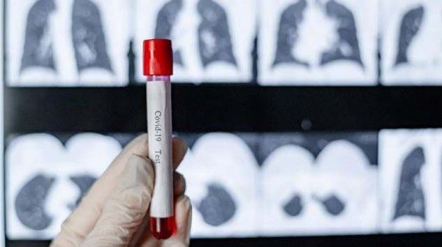 Covid-19 sonrası akciğerlerde kalıcı hasar endişesi