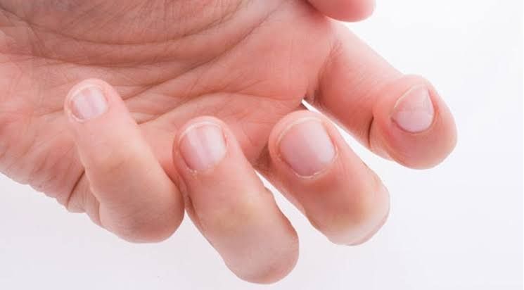 Tırnak problemleri hastalıkların habercisi