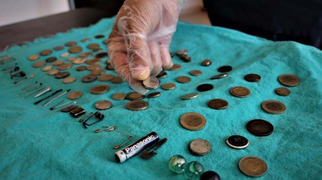 Çocukların midesinden çıkan onlarca yabancı cisim şaşırttı