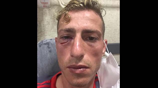 Sivasspor’da Hakan Arslan’ın gözünün altında 3 santimlik açılma oldu