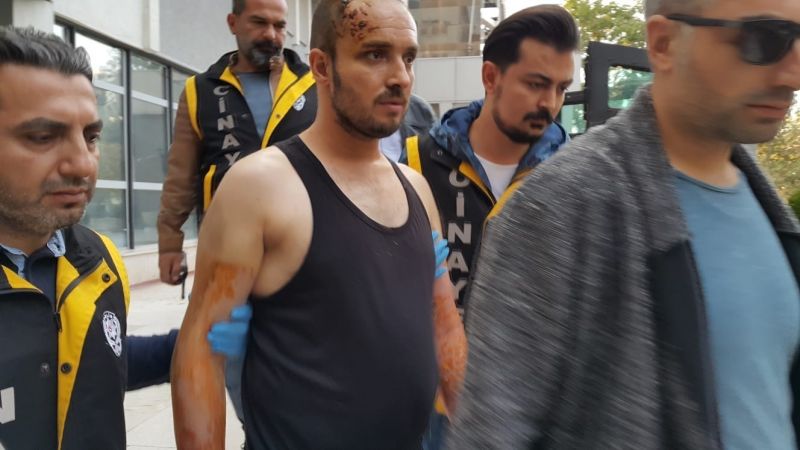 Sevgilisini yakan zanlının ‘iyi hali’ kaldırıldı