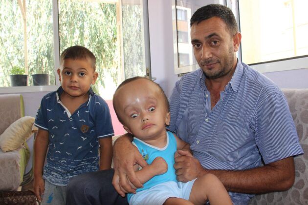 Minik Sercan’ın hayatı 240 bin TL’ye bağlı