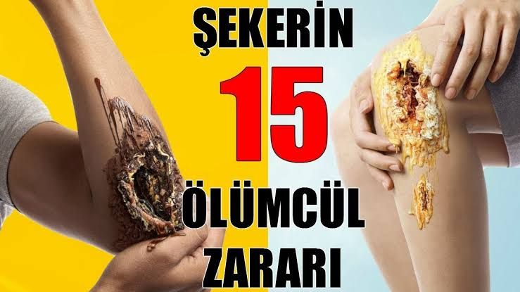 İşte şekerin vücudumuza verdiği zararlar